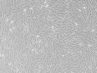 人骨髓间充质干细胞（hMSCs）